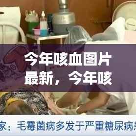 今年咳血图片最新趋势解析,你所不知道的信息全在这