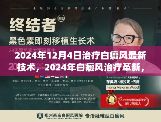 2024年白癜风治疗最新技术解读与应用前景展望,革新与未来趋势