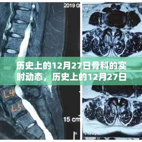 历史上的骨科领域动态,聚焦十二月二十七日的实时进展概览